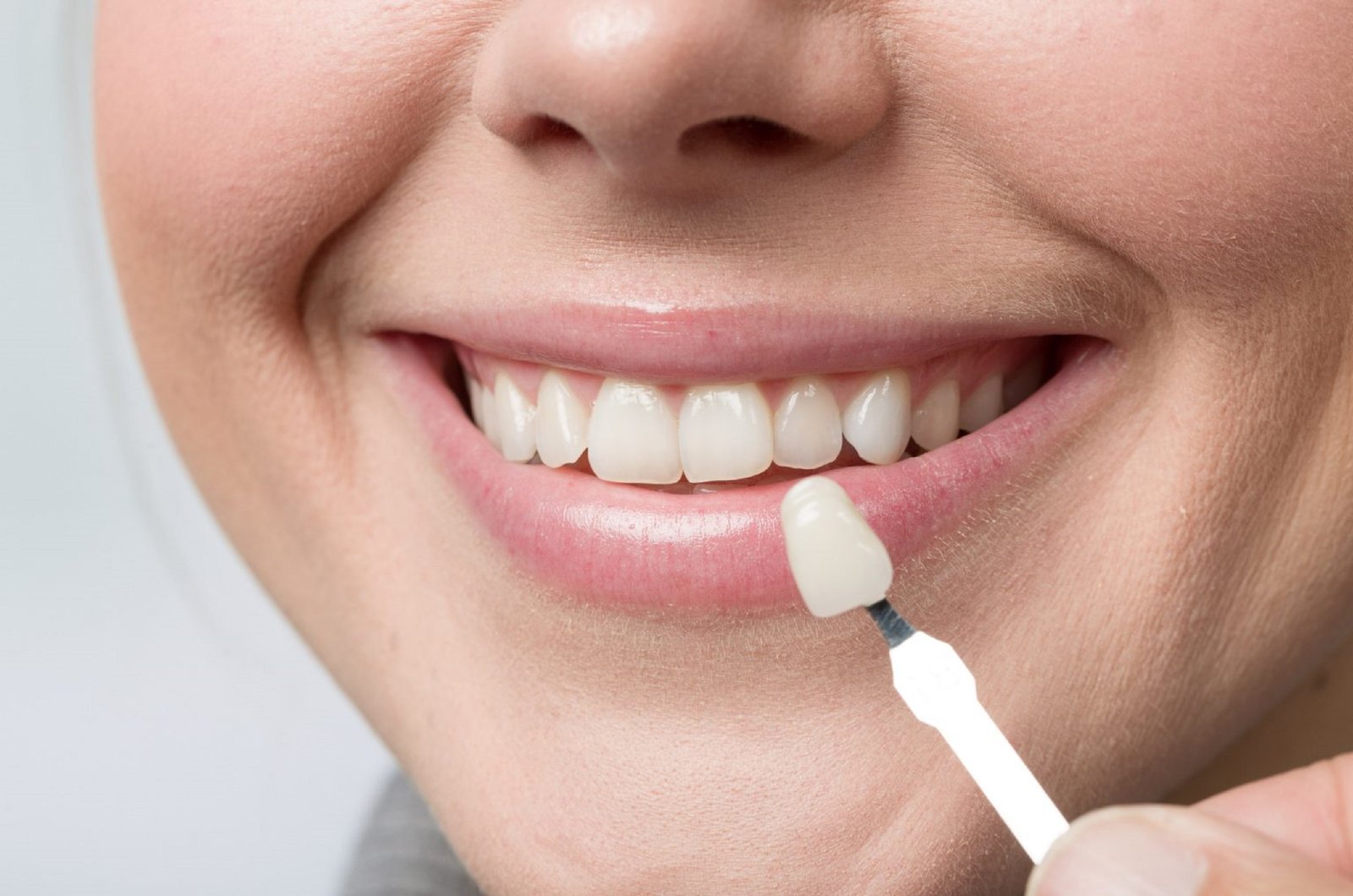 Estética dental