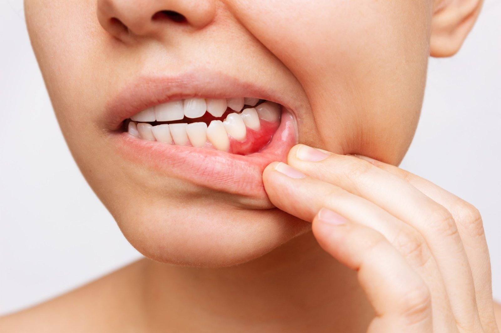 Periodonciaㅤ